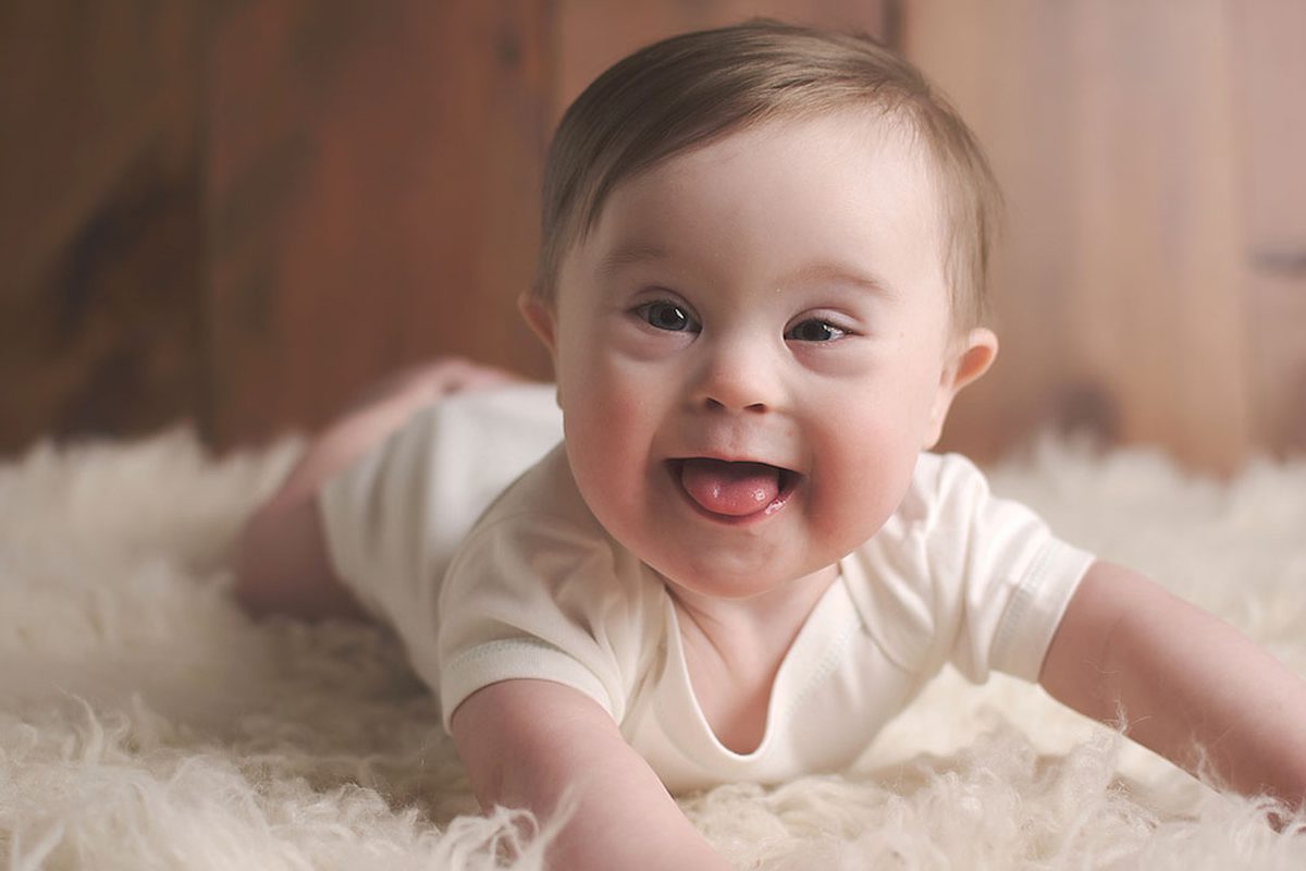 افضل المراكز المتخصصة في علاج متلازمة داون للاطفال في جدة - مركز مراحل العلاج